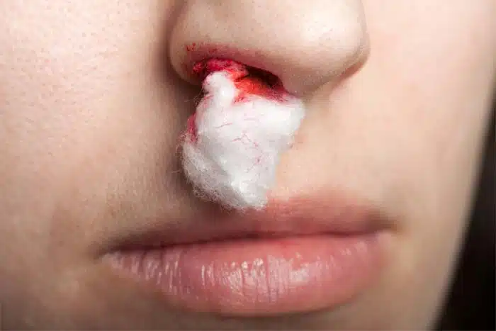 eat rock sugar to prevent nose bleeding