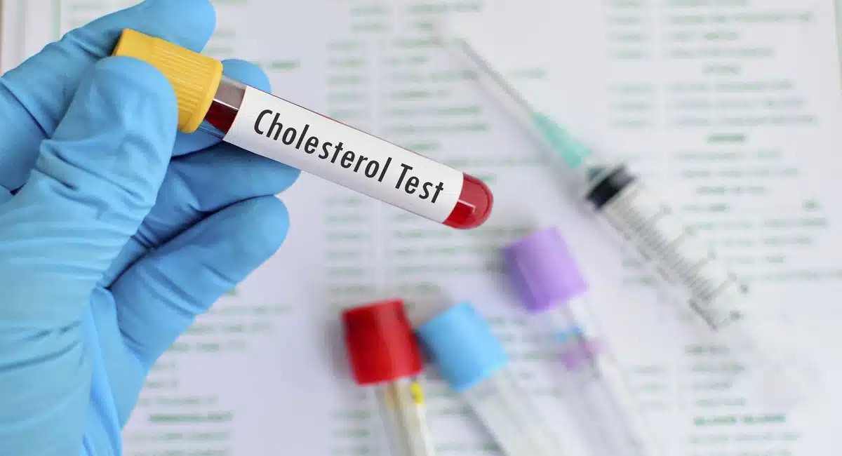 how to find cholesterol symptoms health tips telugu