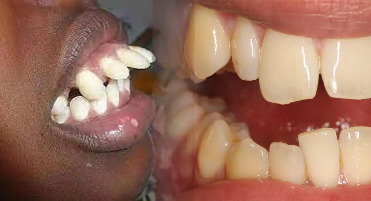 tooth and decay know all details