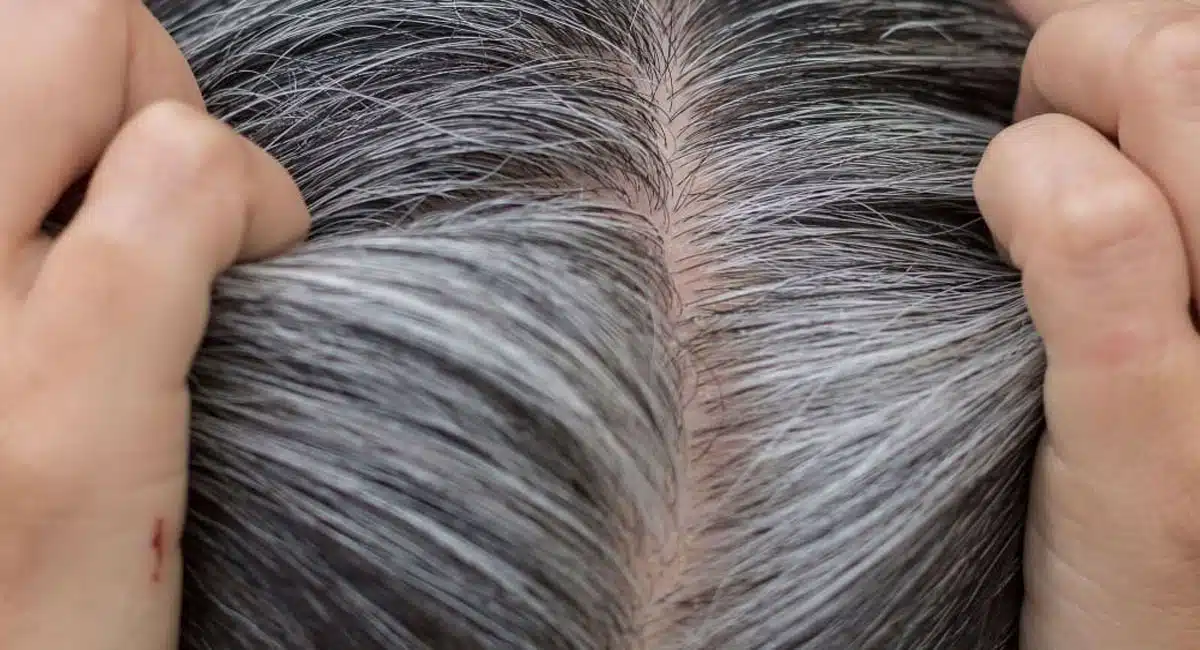 how to prevent white hair home remedies telugu