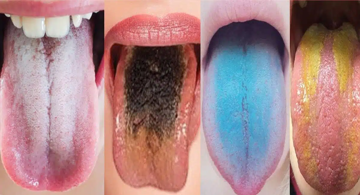 says about your health what your tongue colour