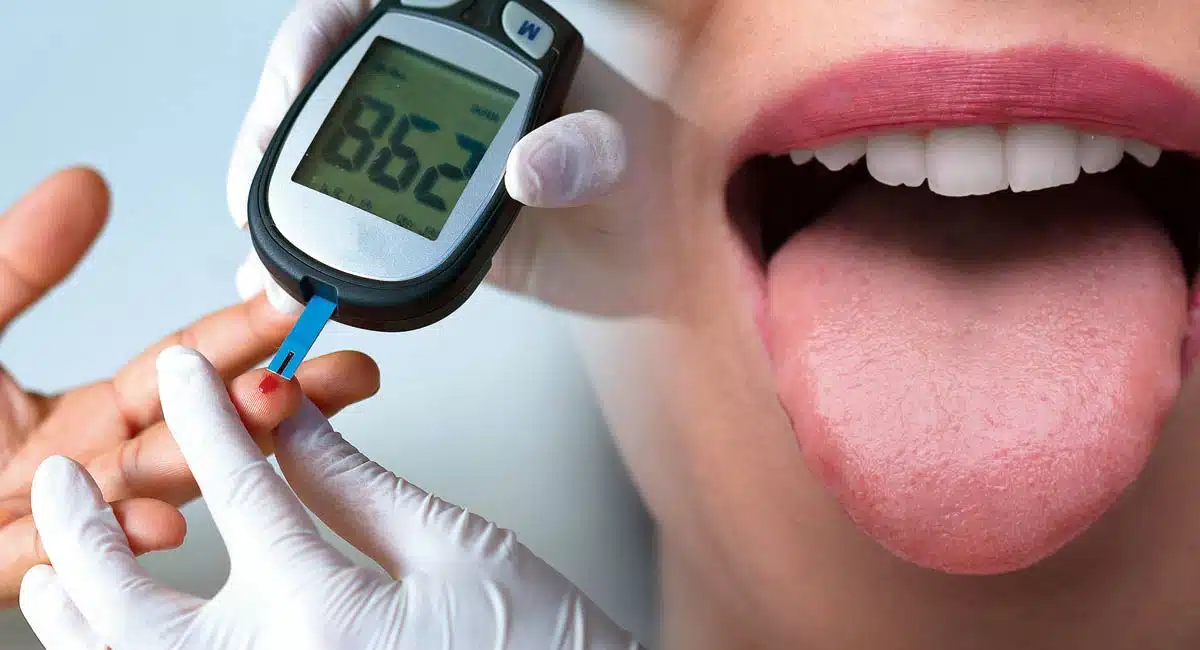 If people with diabetes do not take such precautions, it will affect their teeth
