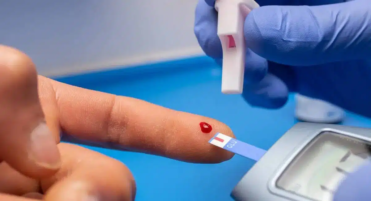 Do you know to blood sugar level reaches 250 mg after eating Diabetes 
