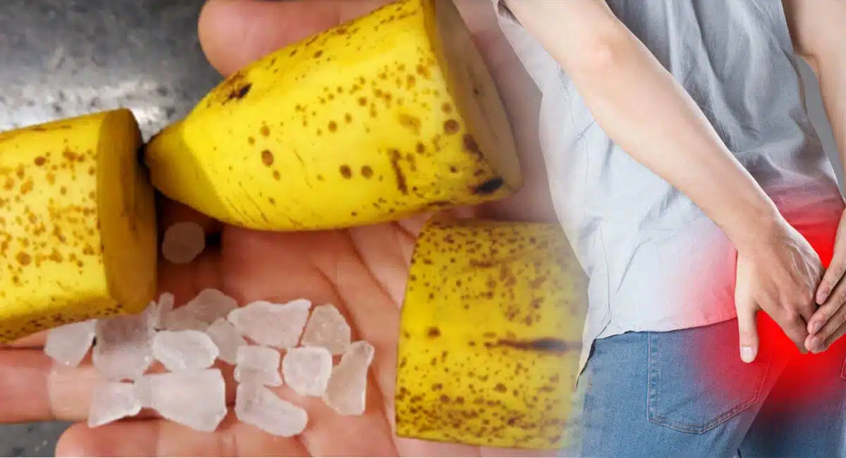 natural remedies for piles