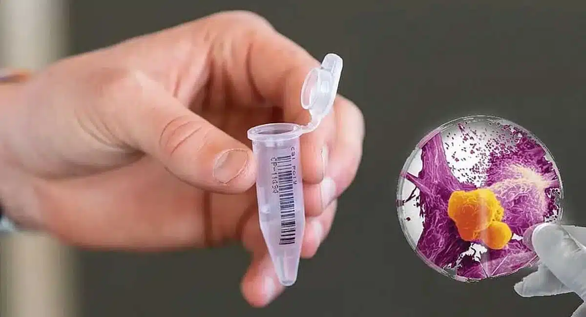 how many types of diseases can be detected with saliva test