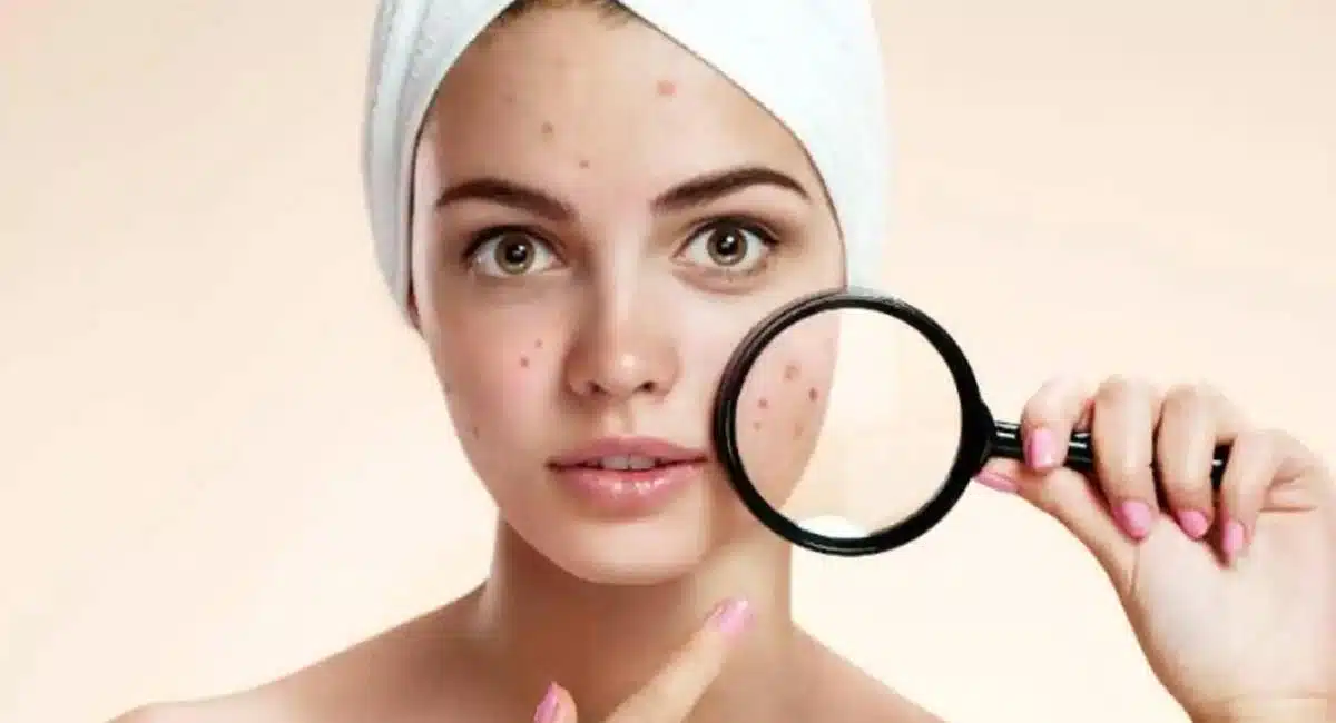 Beauty Tips in Honey yellow