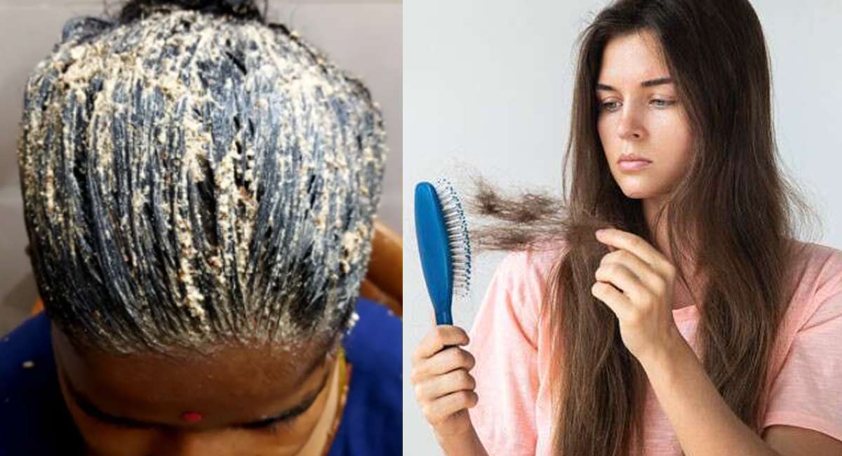 Hair Tips : ఏం చేసినా జుట్టు రాలడం ఆగట్లేదా..? అయితే ఇదొక్కటి ట్రై చేయండి