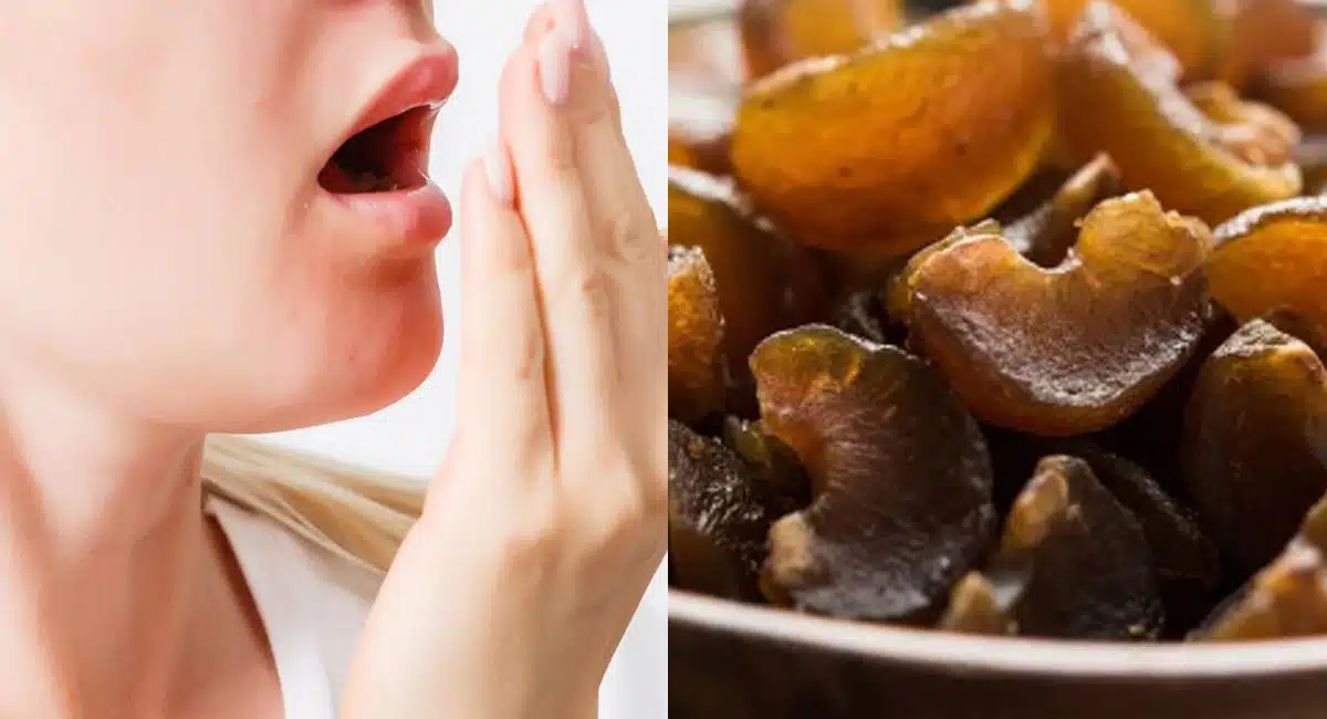 Health Tips amazing home remedy for bleeding gums