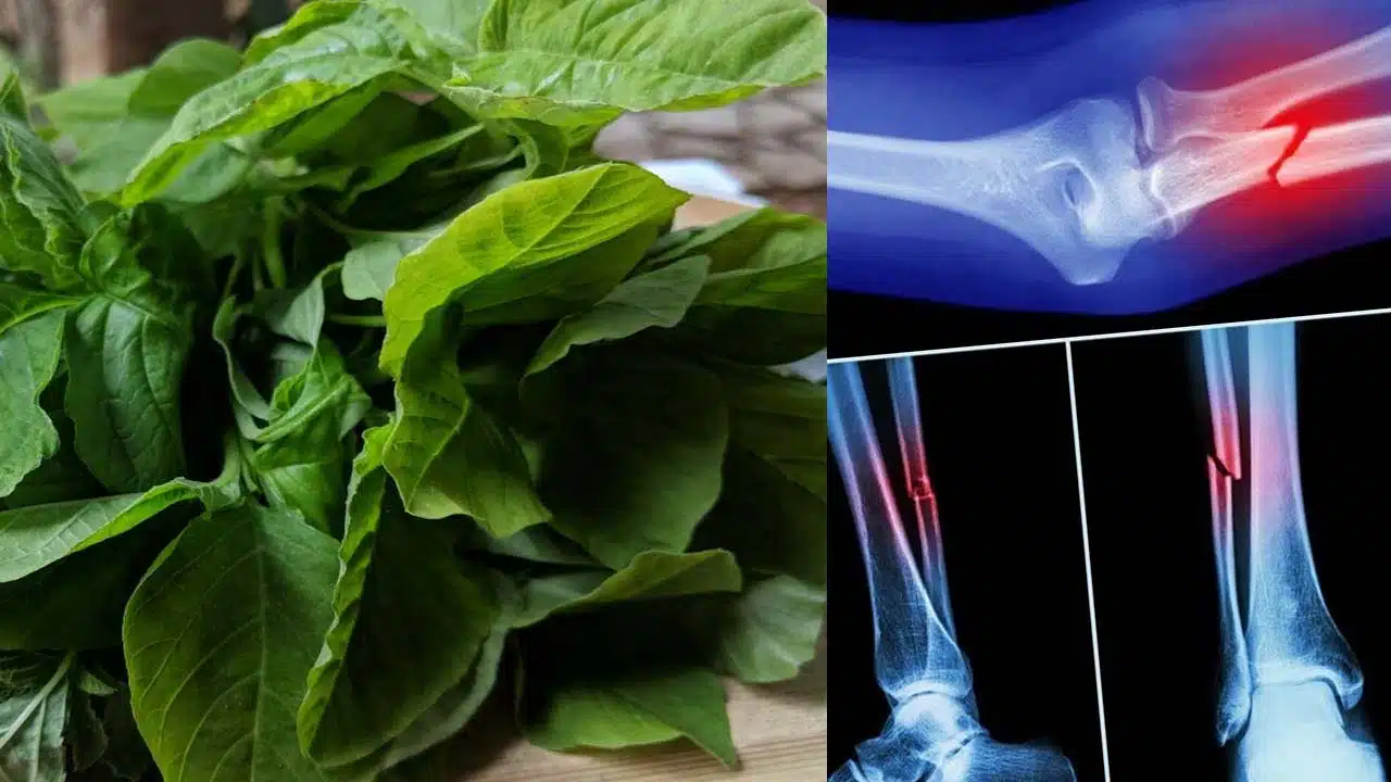 Health benefits of wonderful medicinal plant Thotakura