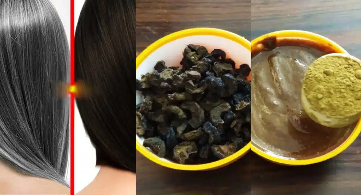 home remedies for white hair removal ayurvedic method