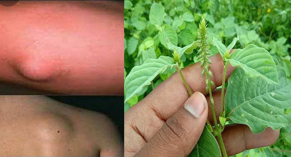 Health Benefits : శరీరంపై ఏర్పడే కొవ్వు గడ్డలను కరిగించే ఆ ఆకులేంటో తెలుసా?