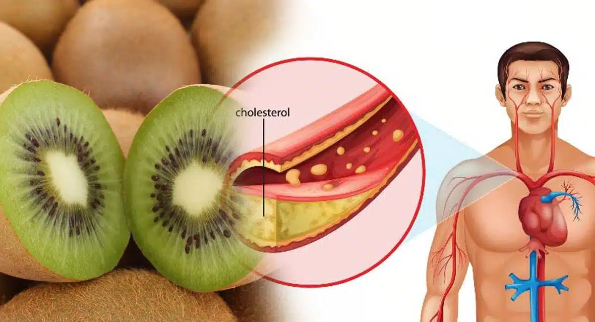 vitamin c rich fruit of kiwi health benifits