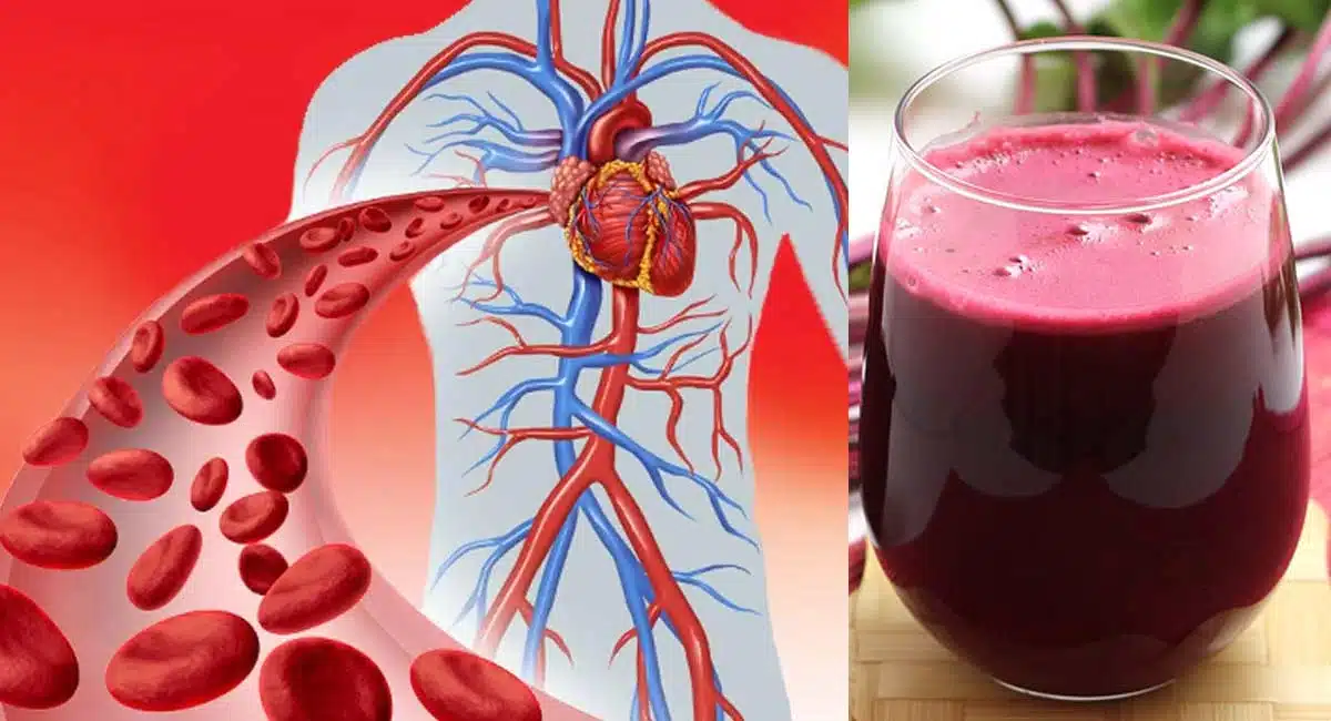 Health Benefits in Beetroot Juice Recipe