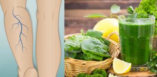Health Benefits how to get rid of body pains in Leafy greens fresh fruits fresh vegetables