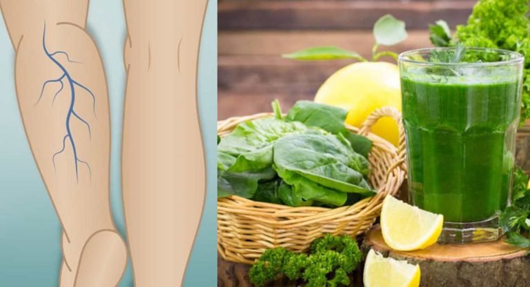 Health Benefits : నరాల వాపు, నొప్పి ఇట్టే తగ్గిపోతాయి.. రక్తనాళాల్లో బ్లాకేజెస్‌, వాత రోగాలు మటుమాయం