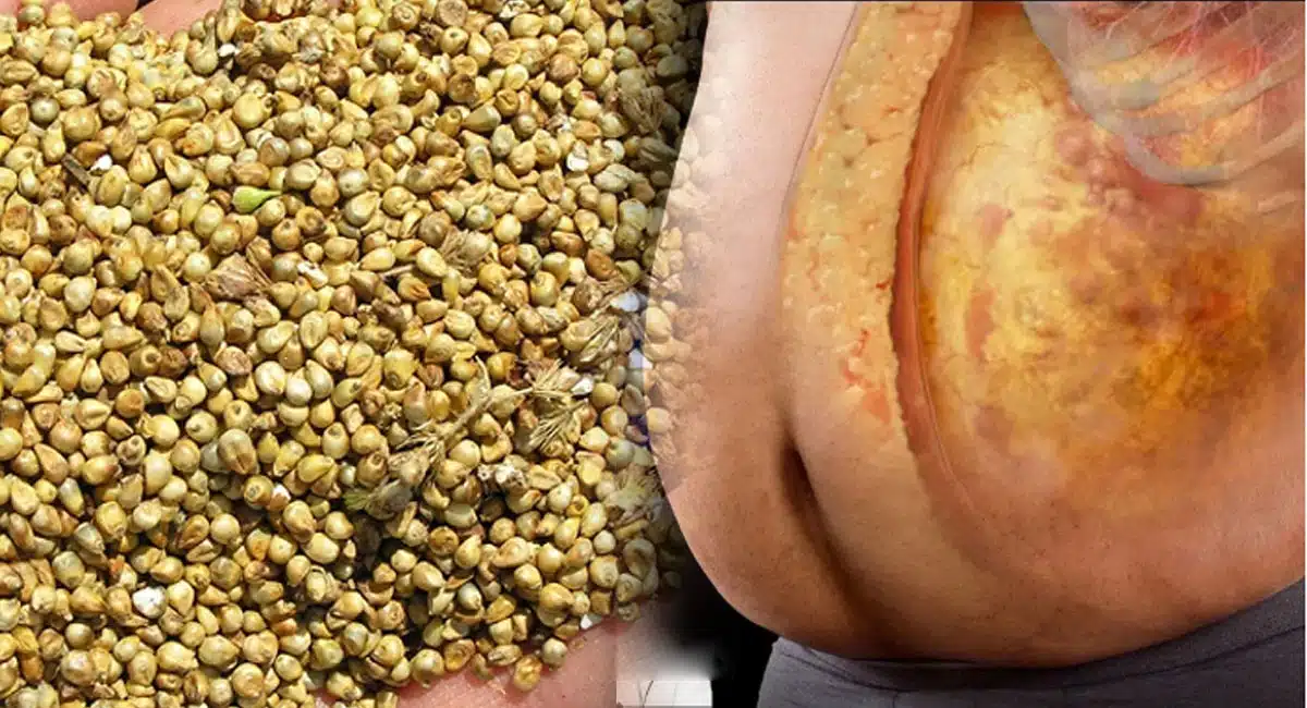 health benefits of millets
