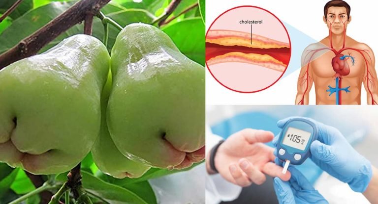 Health Benefits : ఈ పండు తింటే షుగర్ రమ్మన్నా రాదు.. చెడు కొలెస్ట్రాల్ తగ్గుతుంది