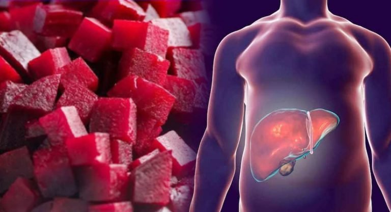 Health Benefits : ఫ్యాటీ లివ‌ర్ తో భాద‌ప‌డితే ఇవి త‌ప్ప‌క తీసుకోండి.. ఇది అస్స‌లు తీసుకోకండి