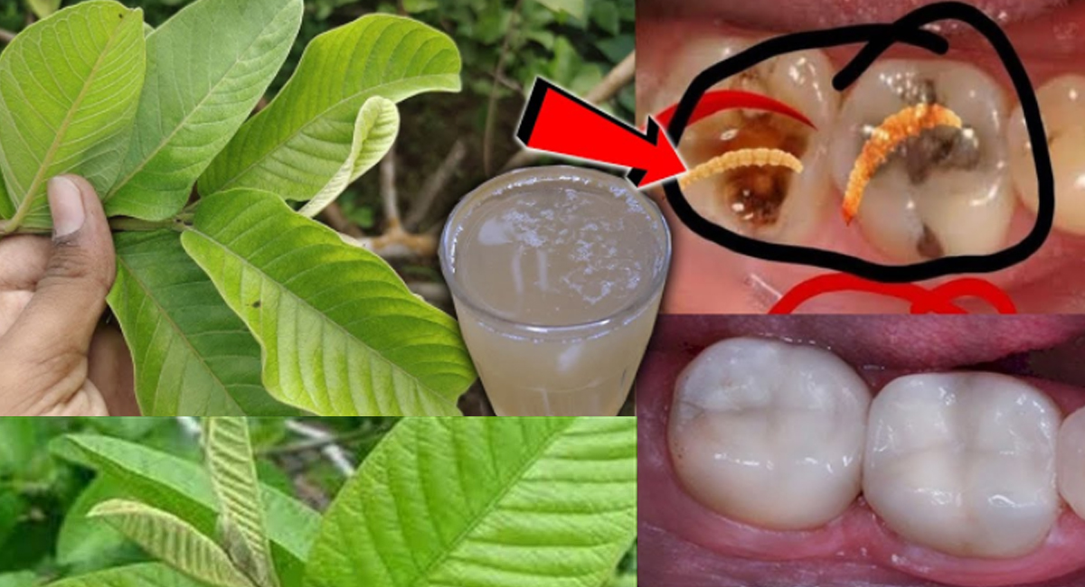 Health Benefits home remedies for tooth decay cavities pulse daily