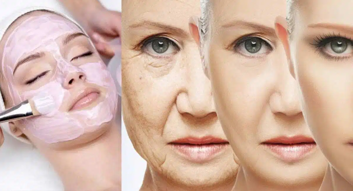 Beauty Tips how to get rid of skin pigmentation naturally