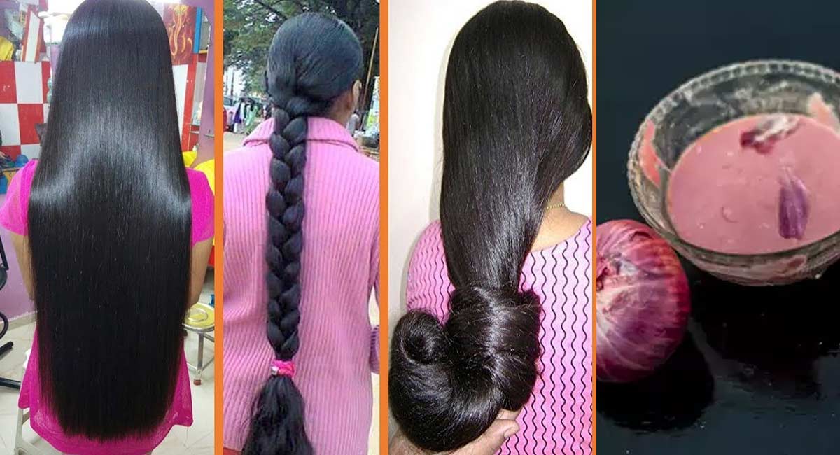 Hair Tips : ఉల్లిరసంలో ఈ పేస్ట్ కలిపి రాస్తే… జుట్టు వద్దన్నా పొడవుగా పెరుగుతుంది.. మీరే చూడండి!