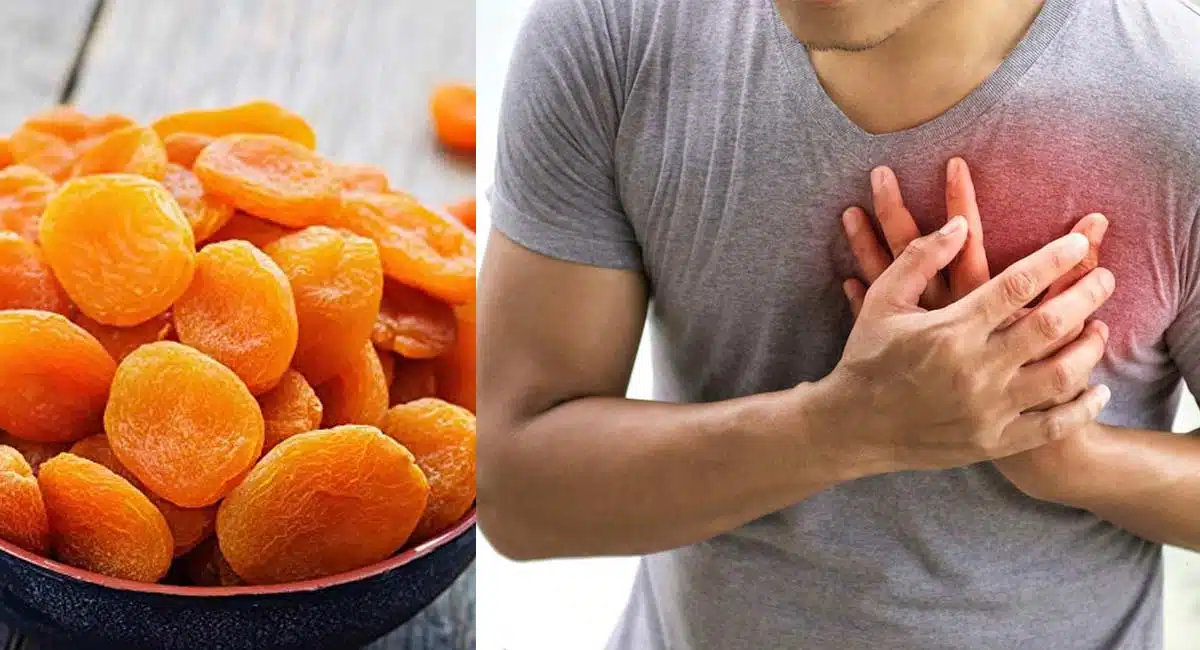 Health Benefits on Apricot Dry Fruits