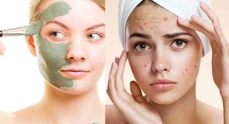 Beauty Tips : ఈ ఆకుల‌తో ఫేస్ ప్యాక్ వేసుకుంటే… ఇక పార్ల‌ర్ కి వెళ్ల‌న‌వ‌స‌రం లేదు…