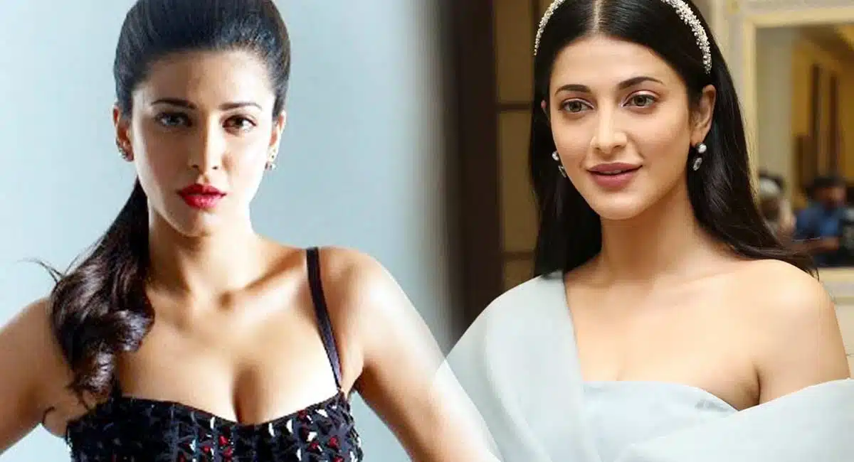 Shruti Haasan seems to have fixed them