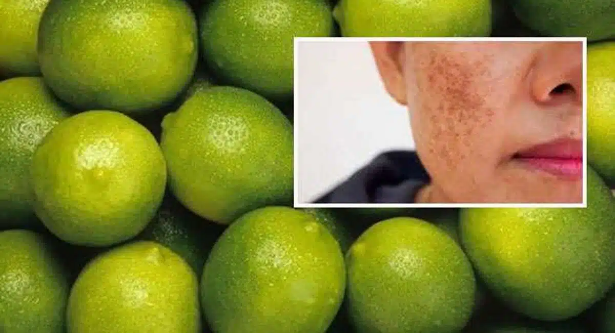 Beauty Tips remove black spots on your face
