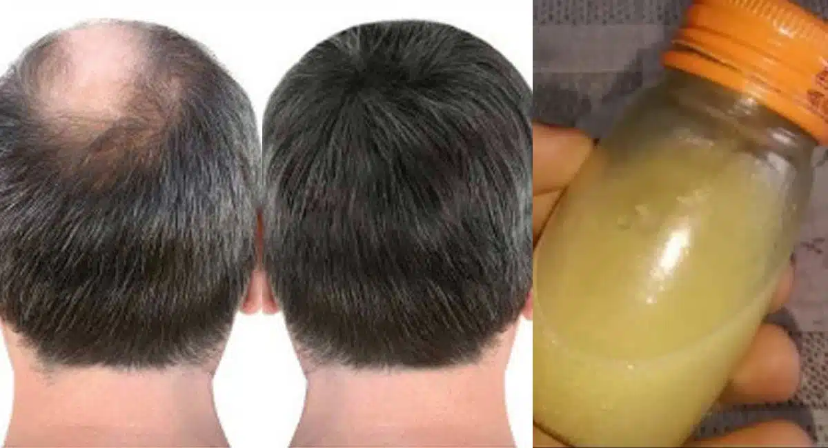 hair growth home tips in telugu
