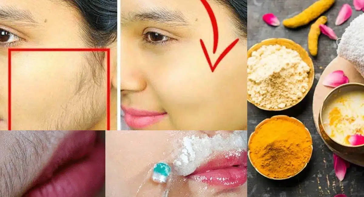 Beauty Tips home remedies for hair removal on face