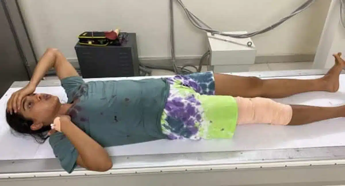 samyuktha hegde injured