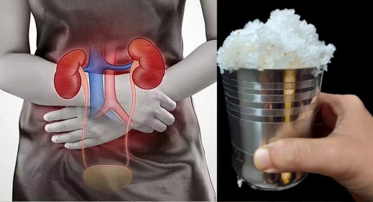 Health Benefits : కాల్షియం తక్కువగా, ఆకలి లేకపోయినా, యూరిక్ యాసిడ్ ఉన్న, ఇలాంటి సమస్యలు అన్నిటికీ ఇది వాడి చూడండి…