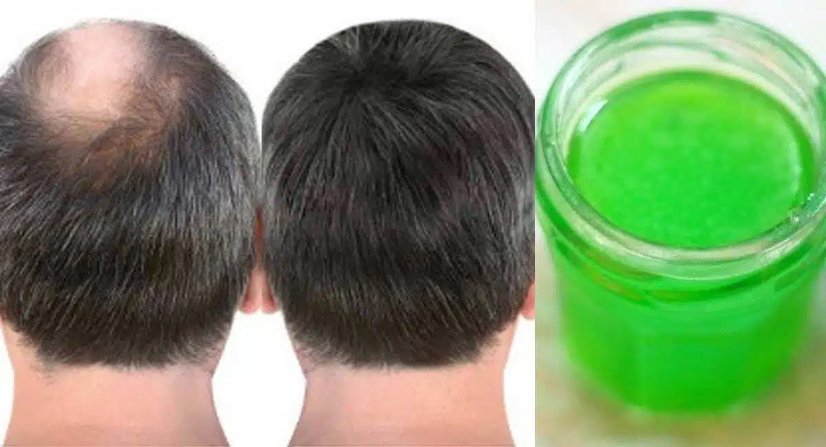 Hair Tips Use This Oil To Get Hair On Your Bald