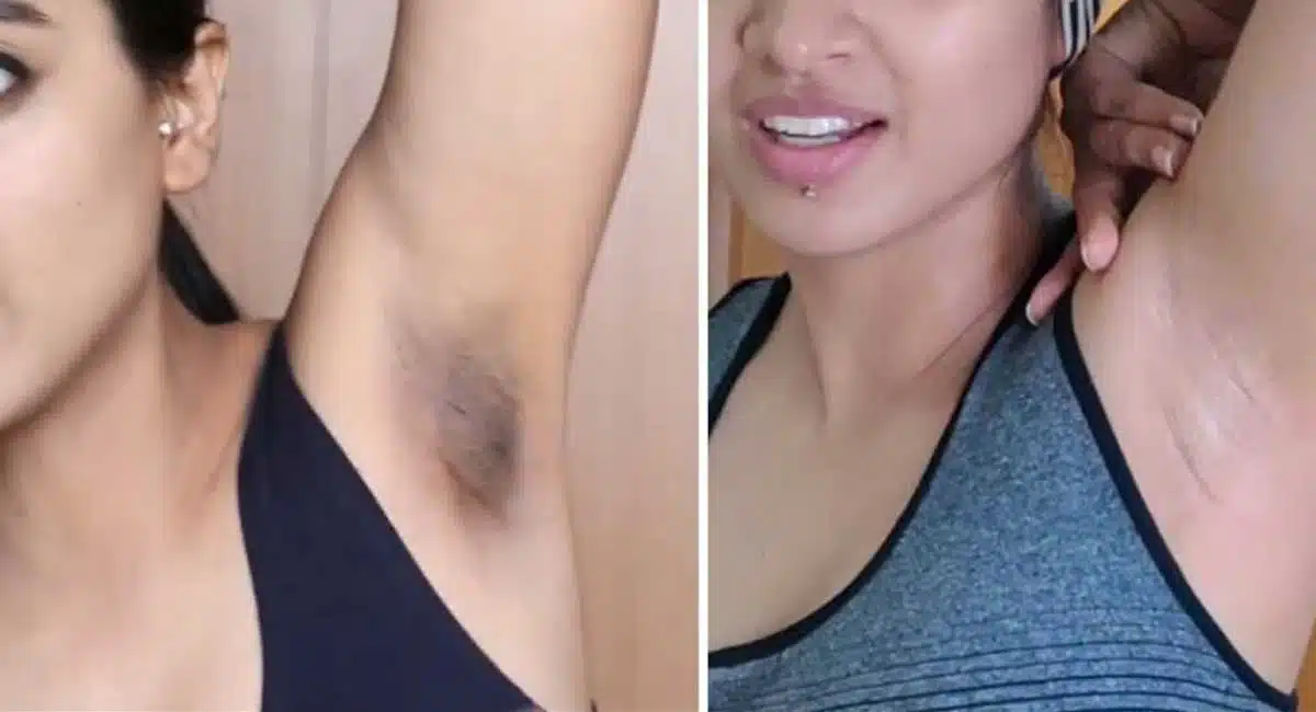 Helth Tips Use this tips for black in armpits