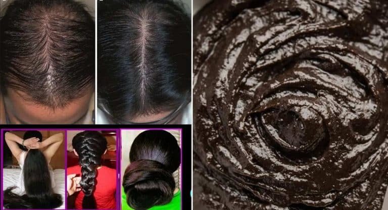Hair Tips : ఈ చిట్కాతో రెండు లాభాలు జుట్టు పెరుగుతుంది… కొలెస్ట్రాల్ తగ్గుతుంది…