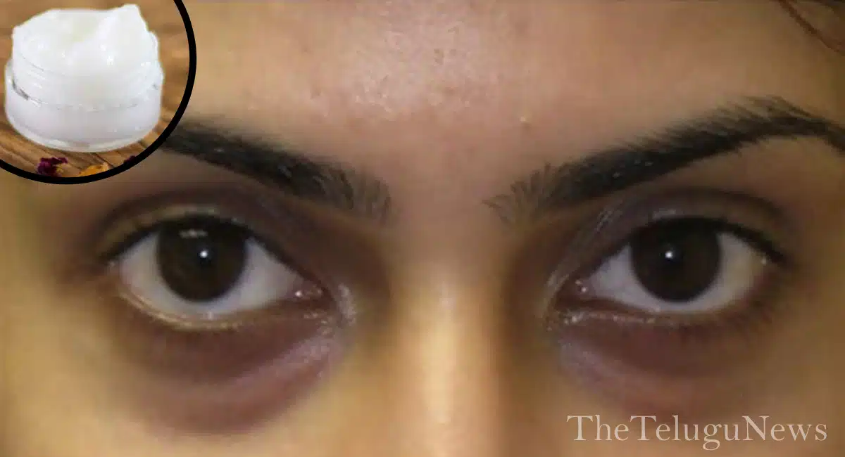 Health Tips to remove Eye Dark Circles with these Home remedy