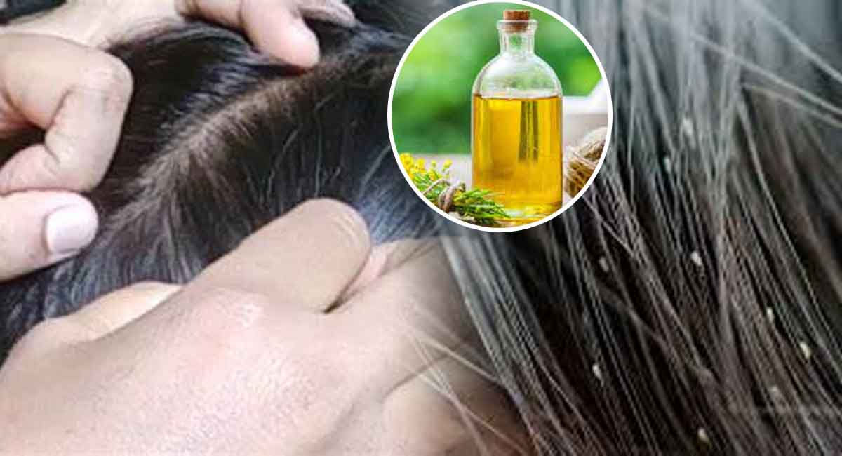 Hair Tips : తలలో పేలు పోవాలంటే… నూనెలో ఈ ఒక్కటి కలసి రాస్తే చాలు…