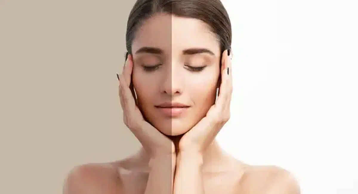 Health tips these remedy Black skin get to white