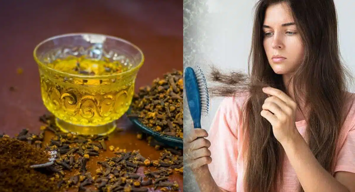 Hair Tips Use This Oil To Get Hair On Your Bald