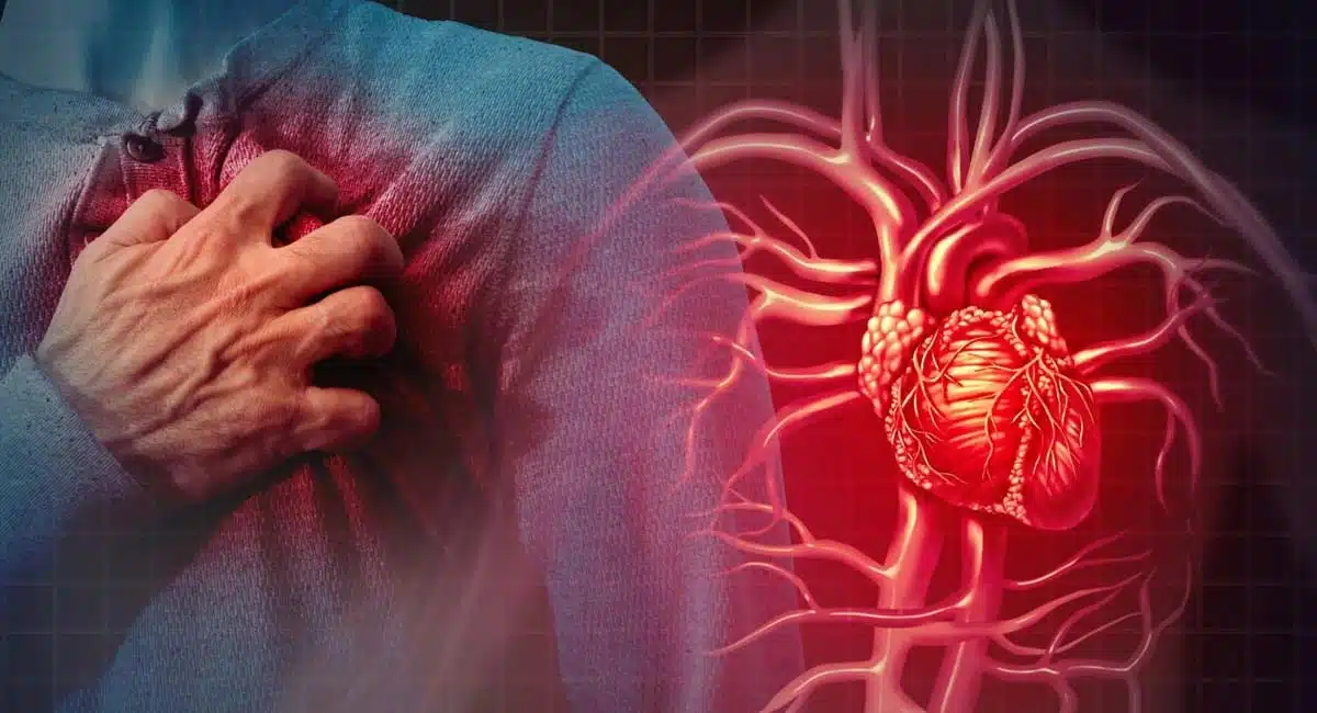 What are the first precautions to take when having a heart attack