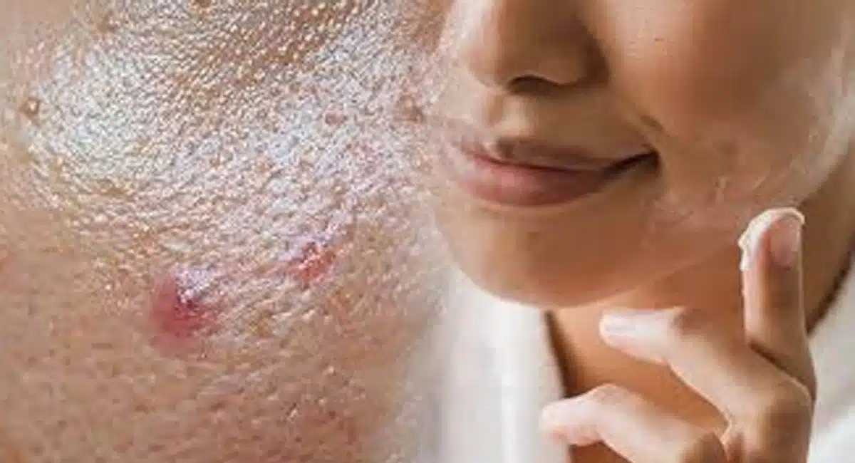 Beauty tips these remedy remove tan in hands, legs