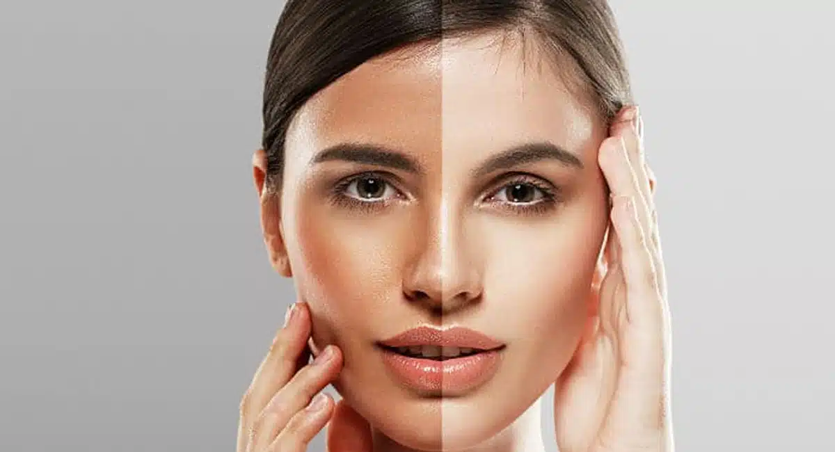 Beauty Tips how black face will turn white