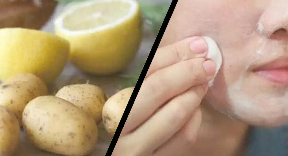 Beauty Tips potato juice for face In telugu