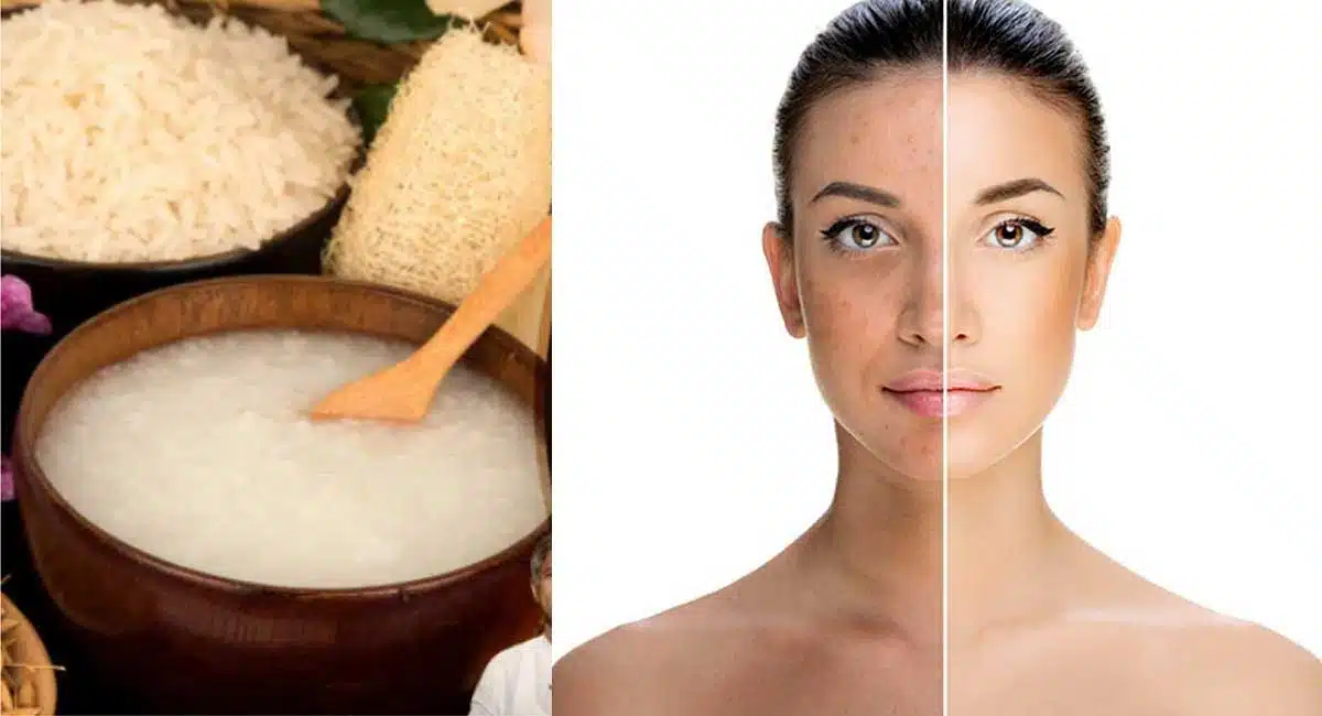 Beauty Tips Even black skin will turn white in ten minutes