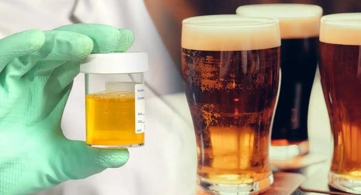 Health Tips urine is cloudy after taking alcohol, take these precautions