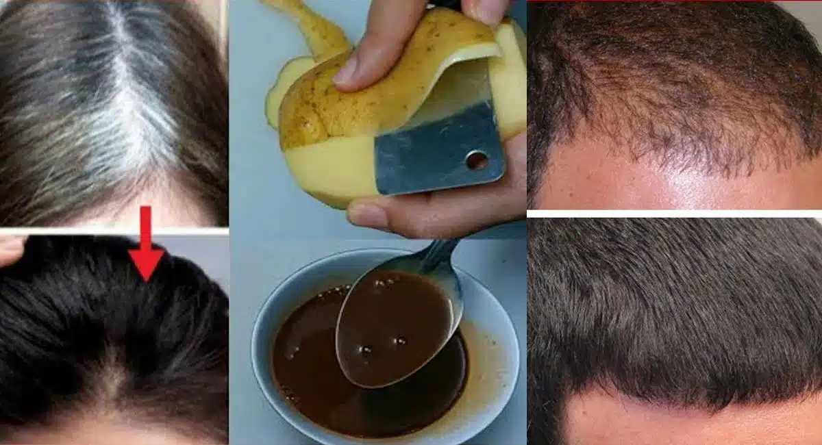 Hair Tips : వాల్ నట్స్ తో ఇలా చేశారంటే… జుట్టు రాలడం తగ్గిపోతుంది…!