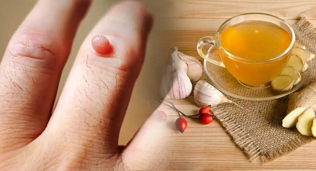 Health Tips on Garlic juice
