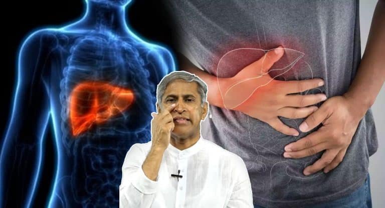 Liver Disease : మీలో ఈ సంకేతాలు కనపడితే జాగ్రత్తలు వహించాలి… లివర్ వ్యాధికి మూలం అవ్వచ్చు…!