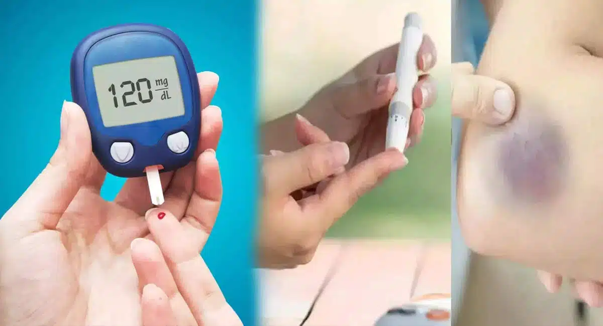 symptoms of low blood sugar